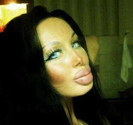 Most-tragic-cosmetic-surgery-on-women-+-pictures3
