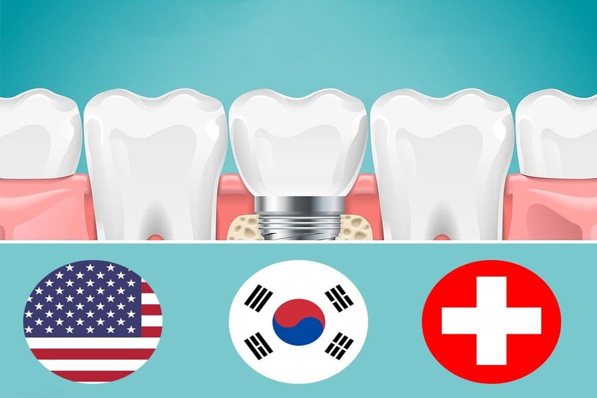 قیمت ایمپلنت دندان ( سوئیسی ، آمریکایی و کره ای )
