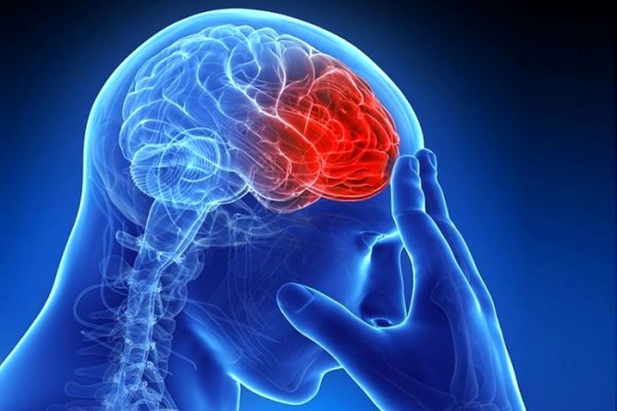 عجیب ترین علت سکته مغزی در افراد چیست؟
